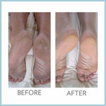 Epoch Sole Solution - Moisturising foot cream for cracked heels, dry feet and callouses