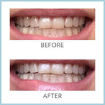 AP24 Whitening Fluoride Toothpaste