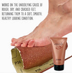 Epoch Sole Solution - Moisturising foot cream for cracked heels, dry feet and callouses