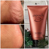 Epoch Sole Solution - Moisturising foot cream for cracked heels, dry feet and callouses