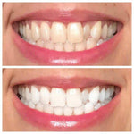 AP24 Whitening Fluoride Toothpaste